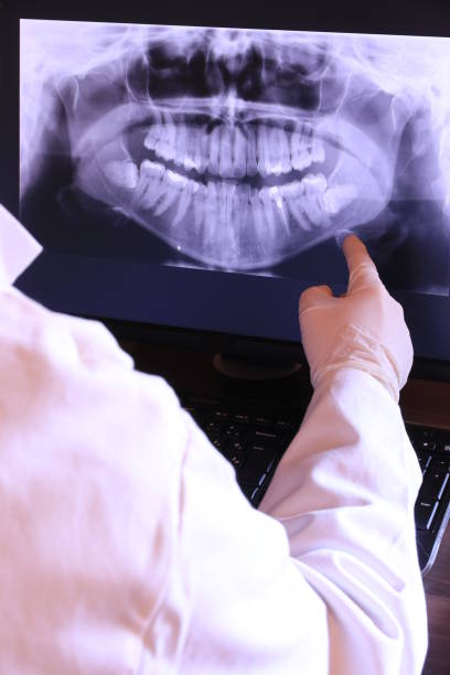 Best Broken or Cracked Tooth Emergency Dentist in Winchester, CA